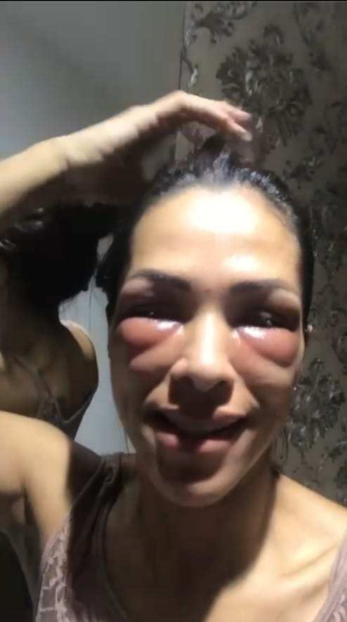 Personal Trainer sofre agressões, é ameaçada de morte pelo ex marido investigador e teme pela vida